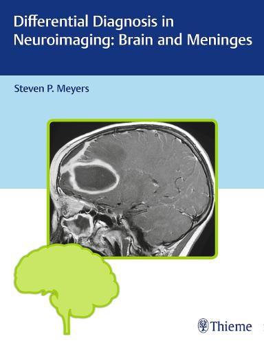 Cover image for Differential Diagnosis in Neuroimaging: Brain and Meninges