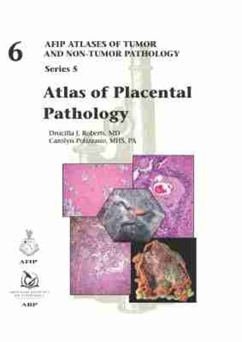 Cover image for Atlas of Placental Pathology