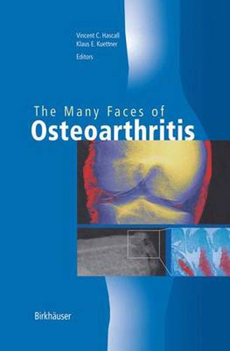 Cover image for The Many Faces of Osteoarthritis