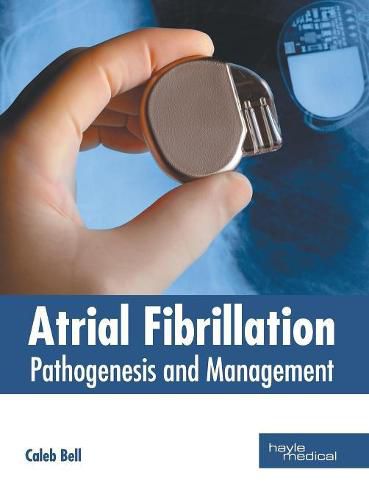 Cover image for Atrial Fibrillation: Pathogenesis and Management