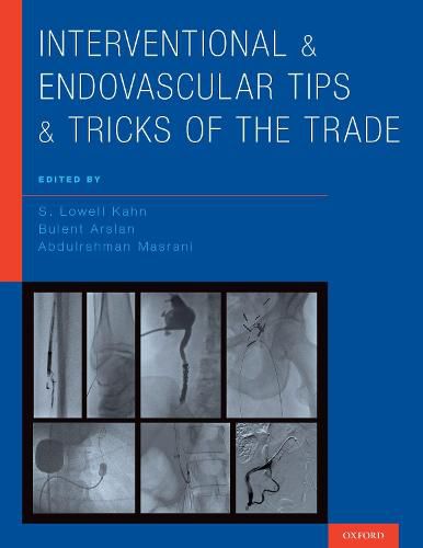 Cover image for Interventional and Endovascular Tips and Tricks of the Trade