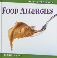 Cover image for Food Allergies