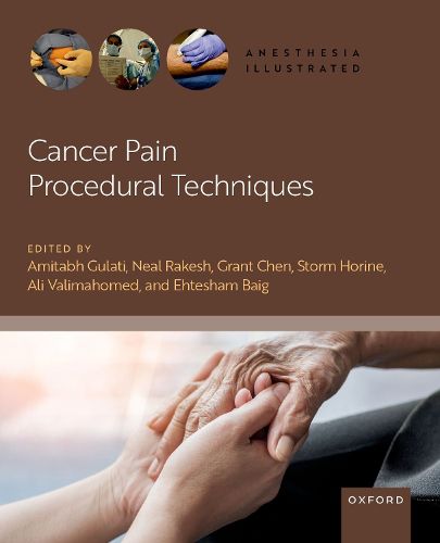 Cover image for Cancer Pain Procedural Techniques