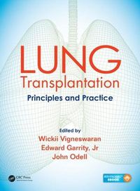 Cover image for LUNG Transplantation: Principles and Practice