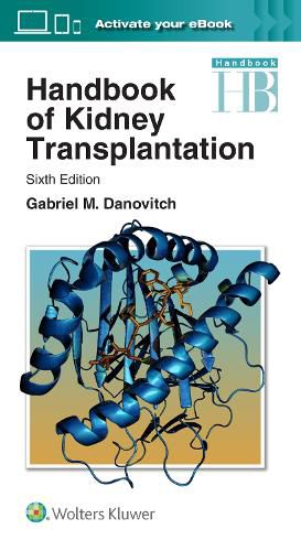 Cover image for Handbook of Kidney Transplantation