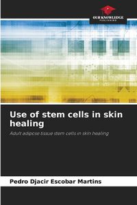 Cover image for Use of stem cells in skin healing