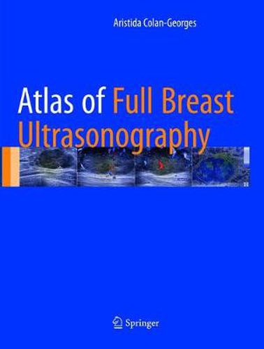 Cover image for Atlas of Full Breast Ultrasonography