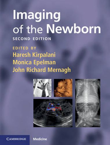 Cover image for Imaging of the Newborn