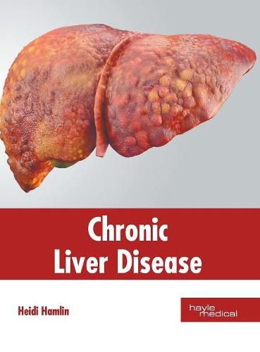 Cover image for Chronic Liver Disease