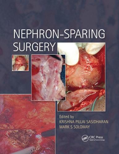 Cover image for Nephron-Sparing Surgery