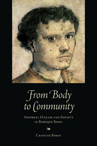 Cover image for From Body to Community: Venereal Disease and Society in Baroque Spain