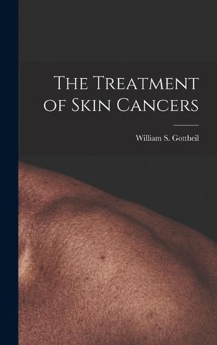 Cover image for The Treatment of Skin Cancers