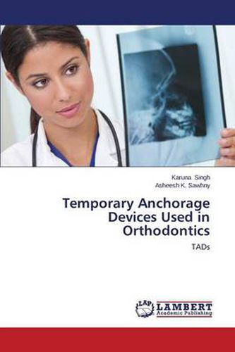 Cover image for Temporary Anchorage Devices Used in Orthodontics