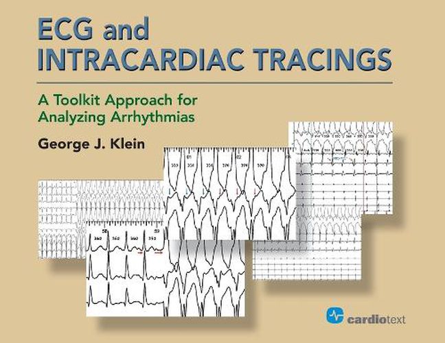 Cover image for ECG and Intracardiac Tracings: A Toolkit Approach for Analyzing Arrhythmias