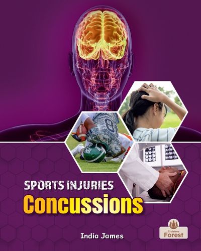 Cover image for Concussions