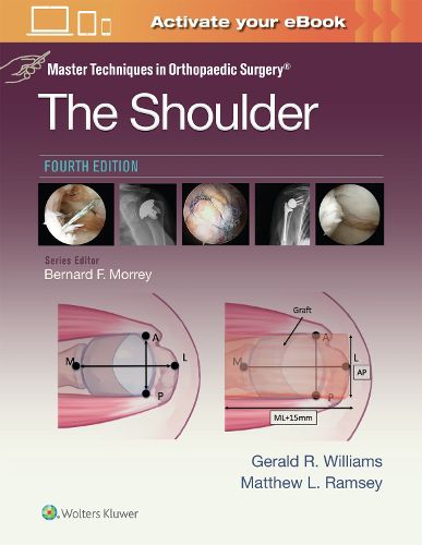 Cover image for Master Techniques in Orthopaedic Surgery: The Shoulder: Print + eBook with Multimedia