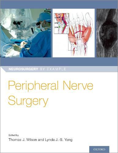 Cover image for Peripheral Nerve Surgery