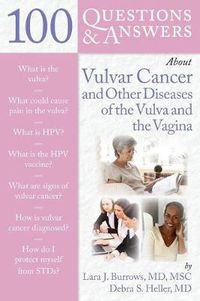 Cover image for 100 Questions  &  Answers About Vulvar Cancer And Other Diseases Of The Vulva And Vagina