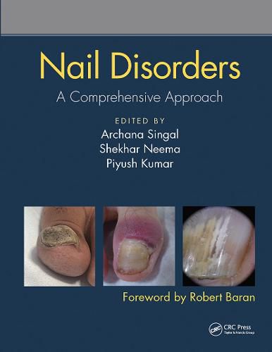 Cover image for Nail Disorders: A Comprehensive Approach