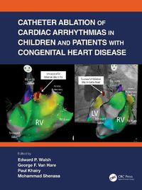 Cover image for Catheter Ablation of Cardiac Arrhythmias in Children and Patients with Congenital Heart Disease