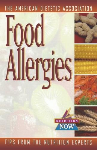 Cover image for Food Allergies