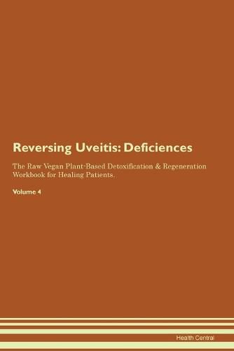 Cover image for Reversing Uveitis