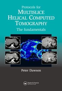 Cover image for Protocols for Multislice Helical Computed Tomography: The Fundamentals