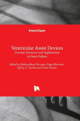 Cover image for Ventricular Assist Devices