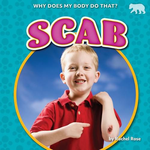 Cover image for Scab