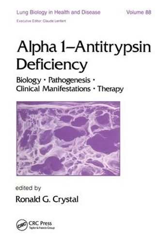 Cover image for Alpha 1 - Antitrypsin Deficiency: Biology-Pathogenesis-Clinical Manifestations-Therapy