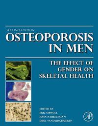 Cover image for Osteoporosis in Men: The Effects of Gender on Skeletal Health