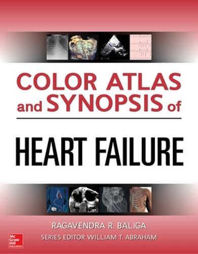 Cover image for Color Atlas and Synopsis of Heart Failure