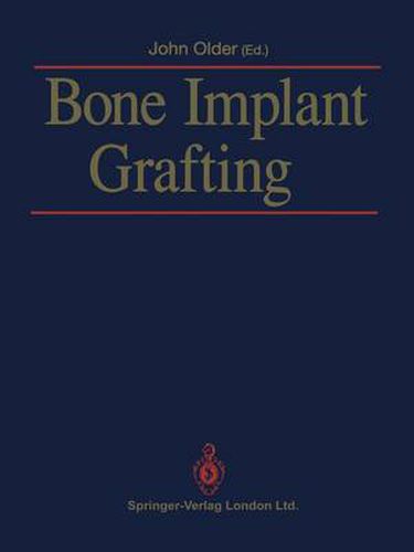 Cover image for Bone Implant Grafting