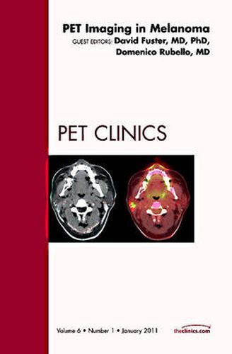Cover image for Pet Imaging in Melanoma, An Issue of PET Clinics