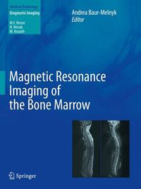 Cover image for Magnetic Resonance Imaging of the Bone Marrow