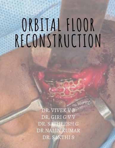 Cover image for Orbital floor reconstruction
