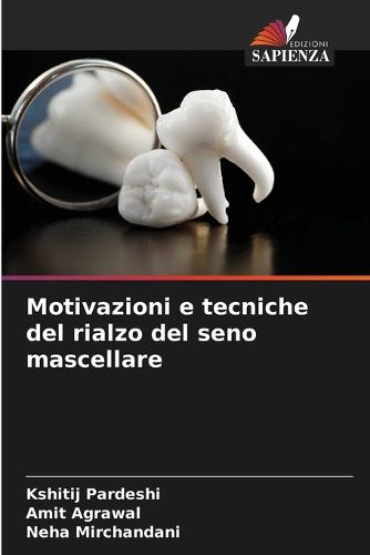 Cover image for Motivazioni e tecniche del rialzo del seno mascellare