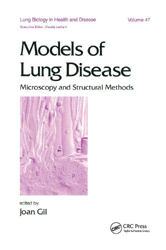 Cover image for Models of Lung Disease: Microscopy and Structural Methods