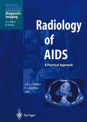 Cover image for Radiology of AIDS