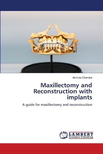 Cover image for Maxillectomy and Reconstruction with implants