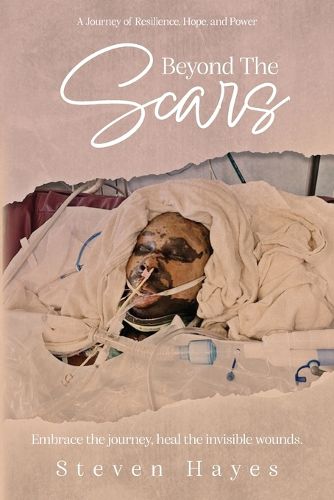 Cover image for Beyond The Scars