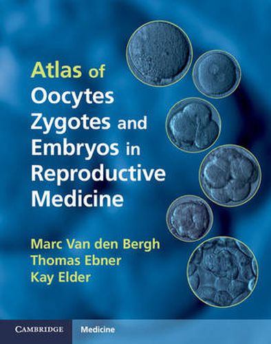 Cover image for Atlas of Oocytes, Zygotes and Embryos in Reproductive Medicine Hardback with CD-ROM