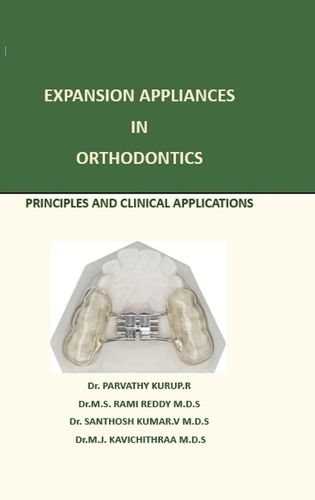 Cover image for Expansion Appliance in Orthodontics
