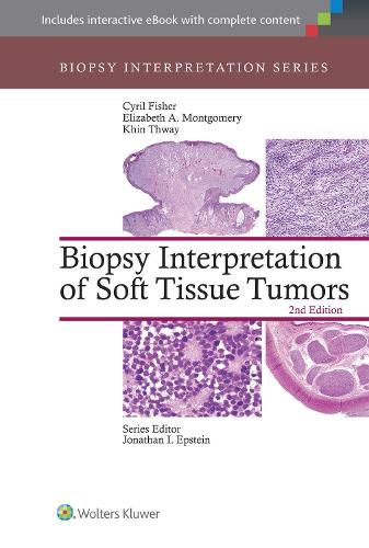 Cover image for Biopsy Interpretation of Soft Tissue Tumors