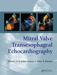 Cover image for Mitral Valve Transesophageal Echocardiography