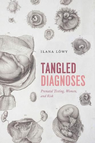 Cover image for Tangled Diagnoses: Prenatal Testing, Women, and Risk