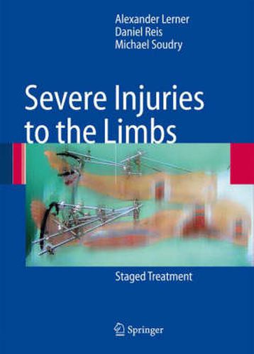 Cover image for Severe Injuries to the Limbs: Staged Treatment