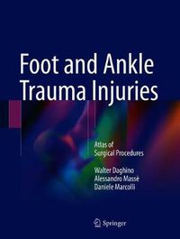 Cover image for Foot and Ankle Trauma Injuries: Atlas of Surgical Procedures