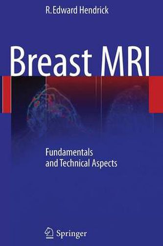 Cover image for Breast MRI: Fundamentals and Technical Aspects