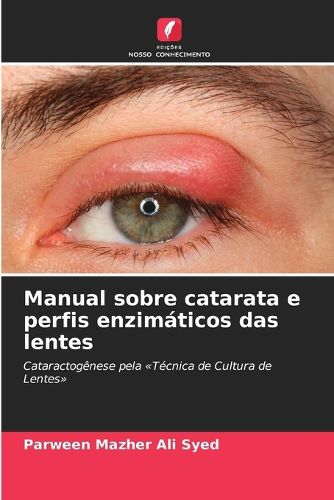 Cover image for Manual sobre catarata e perfis enzimaticos das lentes